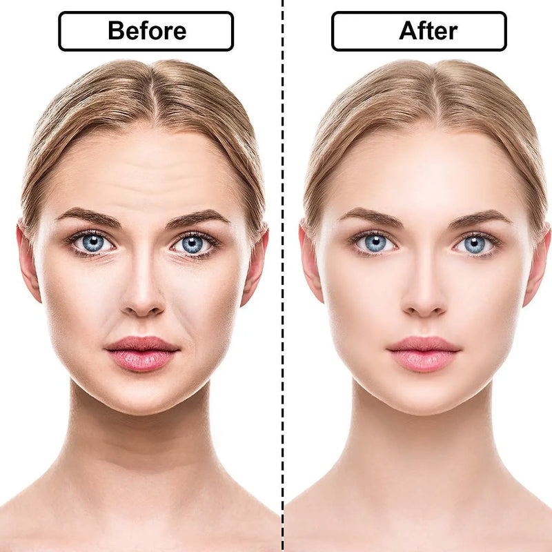 Adesivo de Silicone Antirrugas